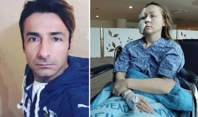 Boşanmak isteyen Ukraynalı eşinin yüzünü 'falçatayla' kesen erkek tahliye edildi!