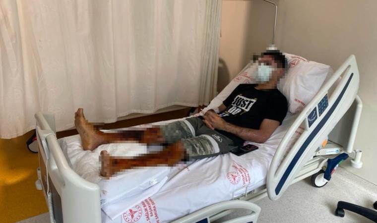Lavabo açıcı bomba gibi patladı, 21 yaşındaki genç dehşeti yaşadı: 'Acıyla hastaneye gittim, halime şükrediyorum'