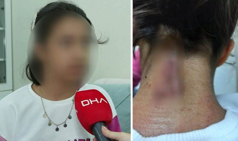 Bahçelievler'de dehşet: Maganda kurşunu 11 yaşındaki çocuğun boynuna isabet etti!