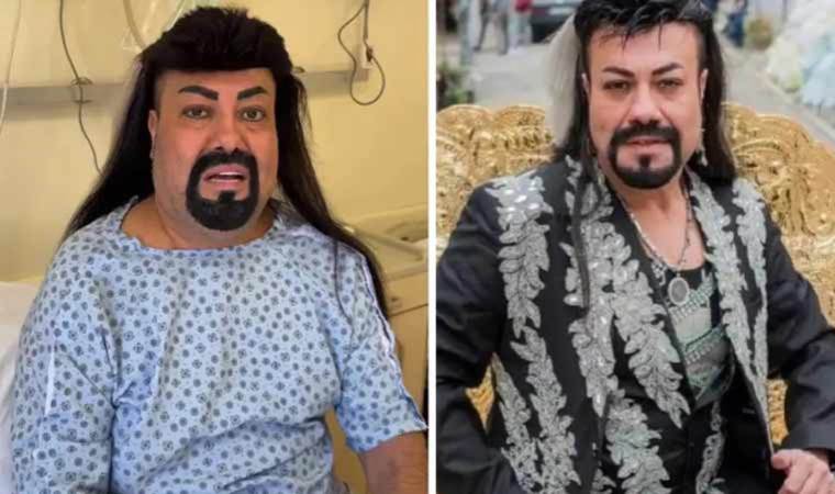 Kobra Murat'ın bağırsağı çatladı: 'Ölüm tehlikesi olan bir ameliyata giriyorum'