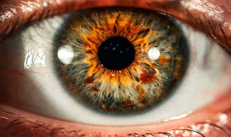 Uzmanından uyarı: 10 kişiden 1'inde körlüğe neden olabilir