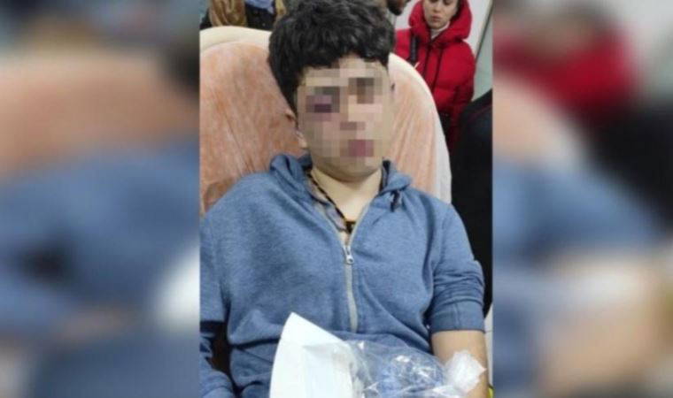 14 yaşındaki çocuğa işkence