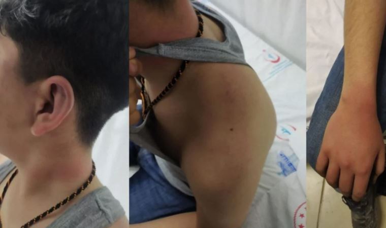 Diyarbakır'da 14 yaşındaki çocuğun darbedilmesiyle ilgili 3 polis tutuklandı