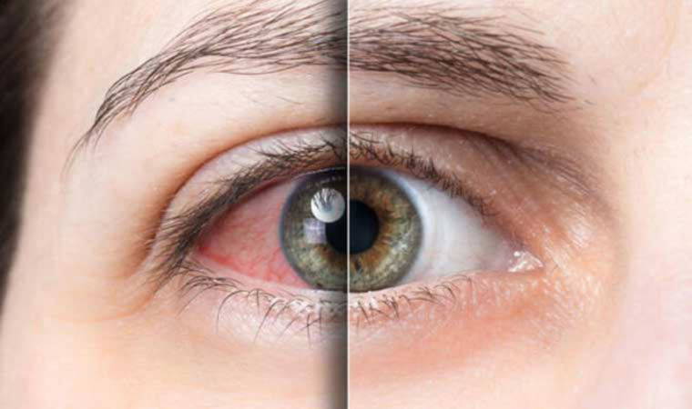 Uzmanı uyardı: 'Göz tembelliği olan çocuklara dikkat'