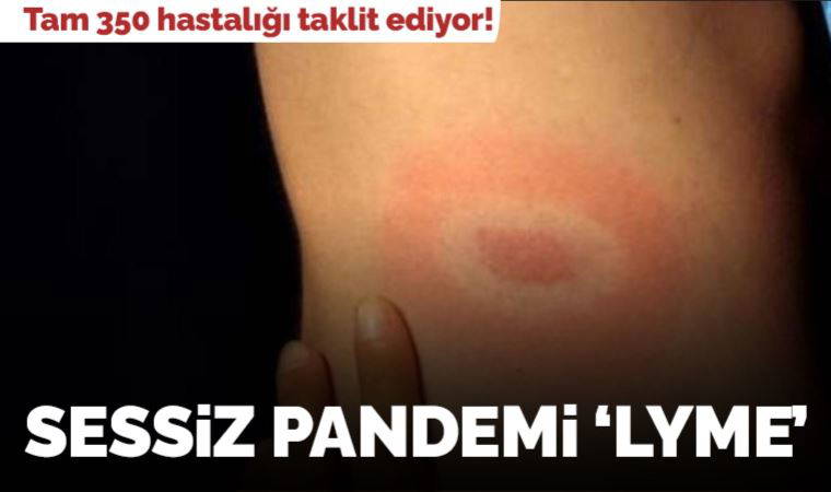 Sessiz pandemi 'Lyme': 350 hastalığı taklit ediyor!