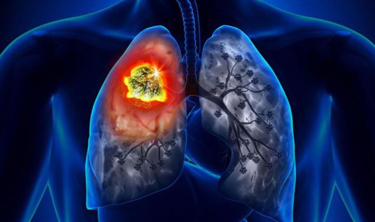 'Dumansız tütün ürünleri sigara kadar tehlikeli'