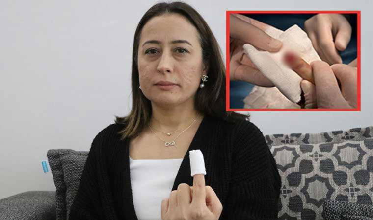 Boşandığı eşini kıskandı... Sevgilisinin parmağını ısırdı