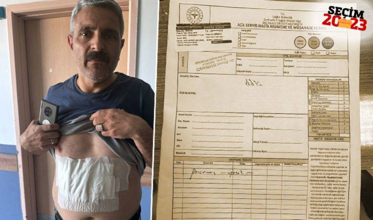 Son Dakika Seçim 2023: CHP'li Salıcı paylaştı... Şanlıurfa'da blok oy kullanılmasına karşı çıktı: Üstüne kaynar su döküldü