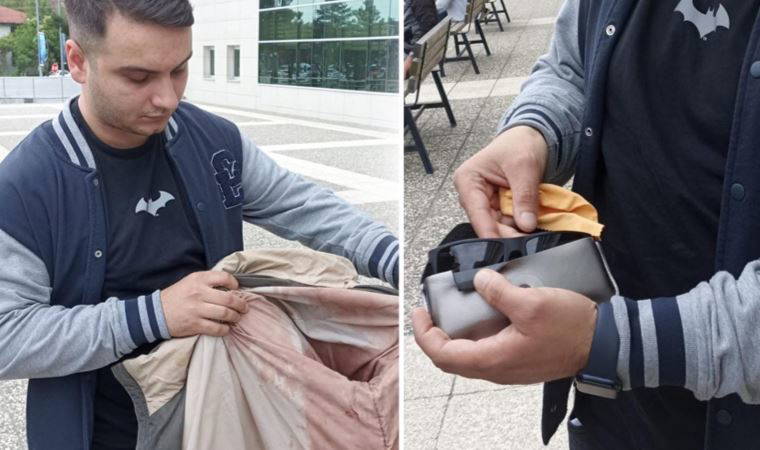 Kardeşinin öldüğü kavgada 'gözlük kılıfı' hayatını kurtardı