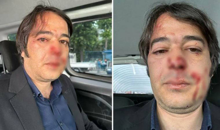 Son dakika... Üsküdar'da İBB İmar Müdürü Ramazan Gülten'e saldıran 2 kişi gözaltına alındı