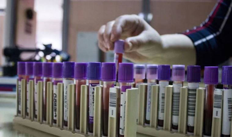 Uzmanından Akdeniz anemisinde demir birikmesi uyarısı