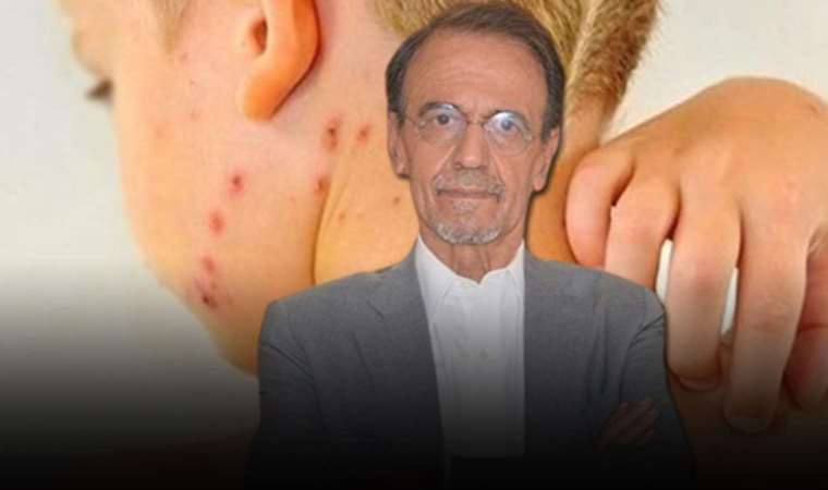 Prof. Dr. Mehmet Ceyhan kızamık salgını riskine karşı uyardı: 'Covid'e benzemez, on kişiden dokuzuna bulaşır'
