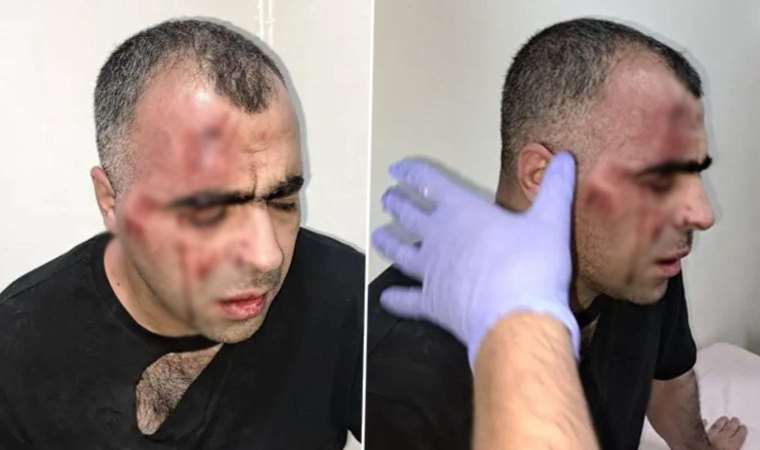 Gazeteci Sinan Aygül'e saldırıda yeni gelişme: Koruma polisi açığa alındı