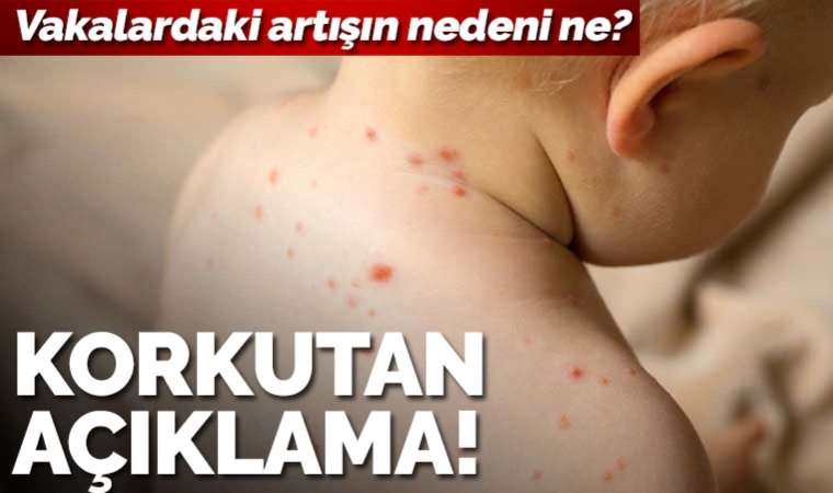 İTO'dan 'kızamık' açıklaması: Artışın nedeni sığınmacılar