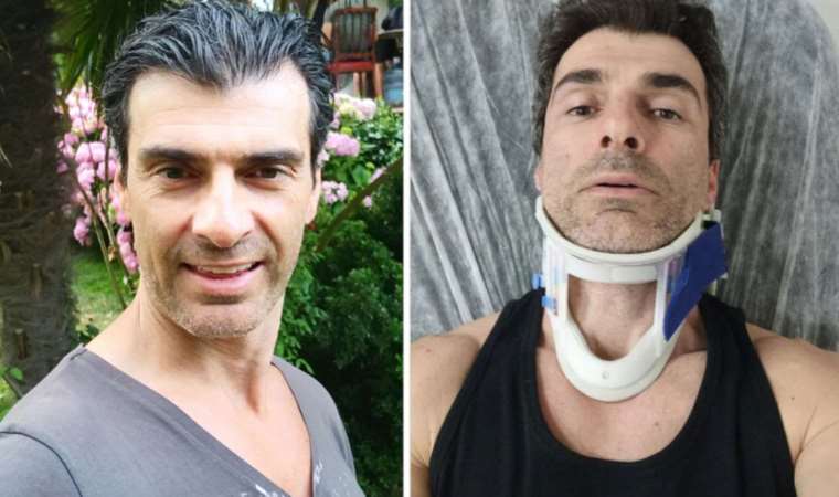 Ünlü oyuncu Özgür Özberk trafikte uyardığı şoför tarafından darbedildi: 'Bu ülkede şansa yaşıyoruz!'