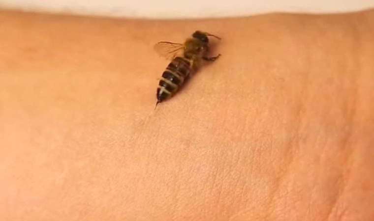 Arı sokması neden bu kadar çok can acıtır?