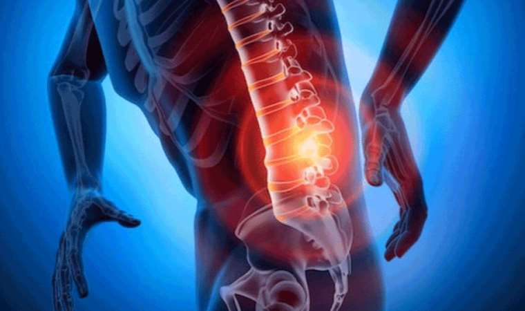 'Tedavi edilmeyen kasık fıtığı sindirimi vurabilir'