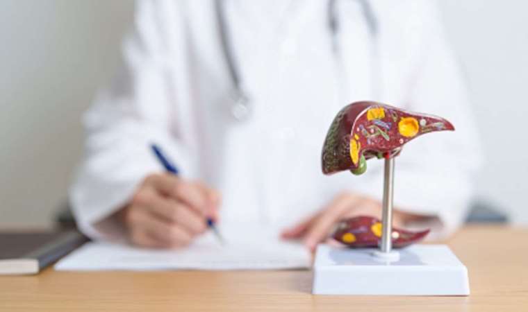 Uzmanlardan kritik uyarı: 'Siroz tedavisi kişiye özeldir, ihmal edilmemelidir'
