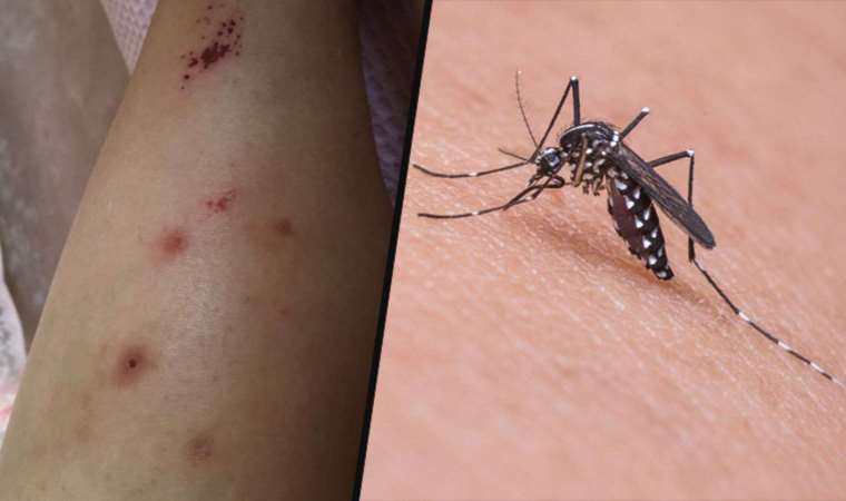 İzmir’de Asya Kaplan Sivrisineği paniği