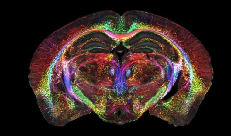 Bu teknoloji beyin görüntülemede devrim yaratacak! Alzheimer, Parkinson ve İnme gibi hastalıklarda erken teşhis imkanı