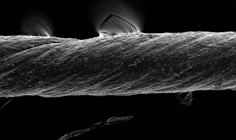 Kendinden ilaçlı dikişler