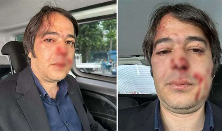 İBB imar müdürüne saldırmıştı...