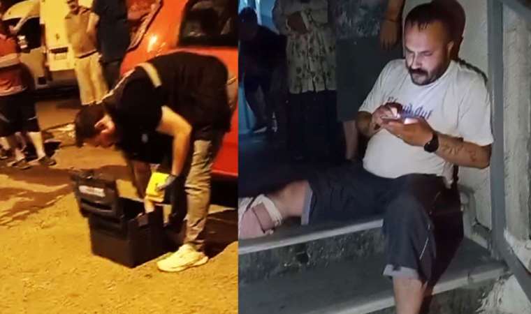 Sultangazi'de ilginç anlar: Bacağından silahla vuruldu, cep telefonuyla oynamaya devam etti