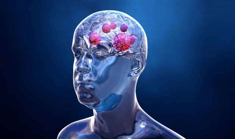Harvard Üniversitesi: Yapay zeka beyin tümörü tedavisine yardımcı olabilir
