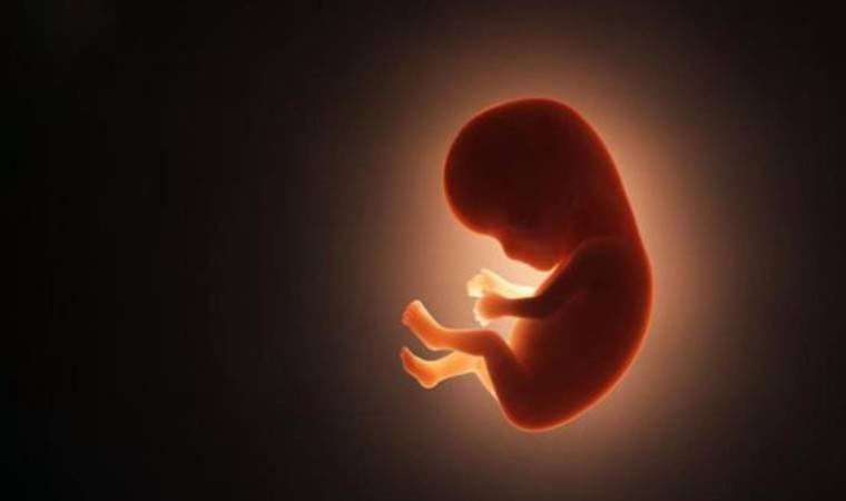 Meksika’da 84 yaşındaki kadının karnında 40 yıllık cenin bulundu