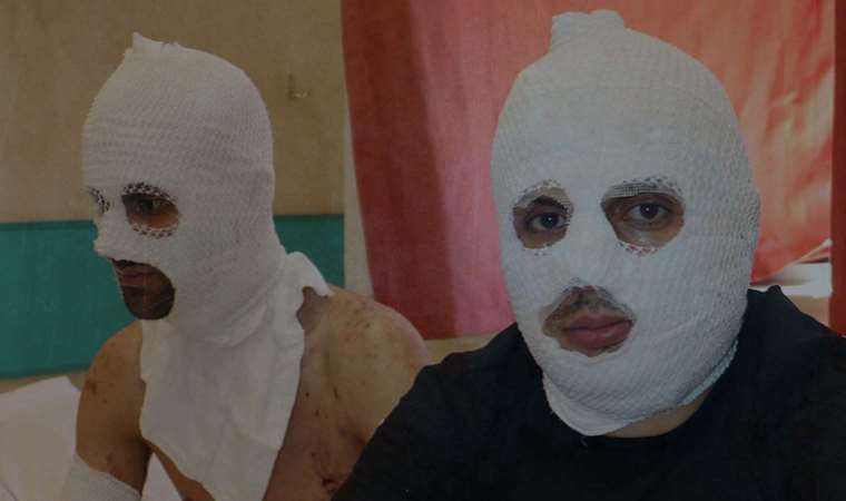 Biri gaz sıkarken diğeri çakmak çaktı; patlamada 2 kişi yaralandı: Ortalık bir anda masmavi oldu