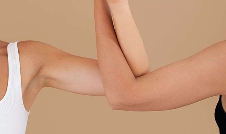 Kol bölgesindeki sarkmaları dert etmeyin: Estetikle eski haline dönüyor