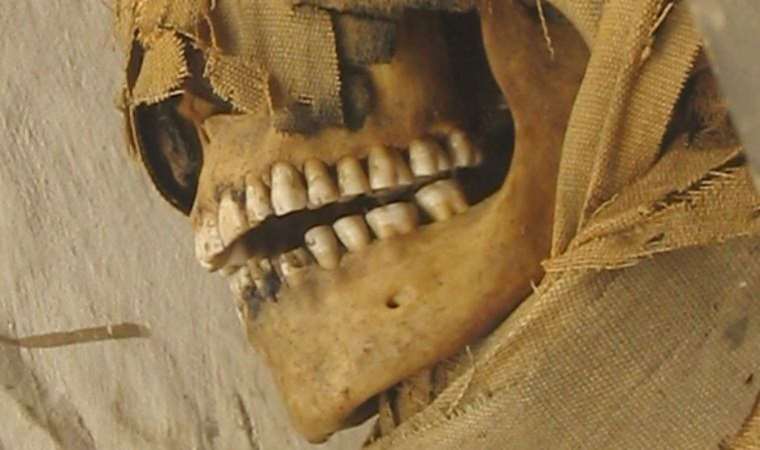 Antik dönemdeki insanların dişleri nasıl bu kadar düzgündü?