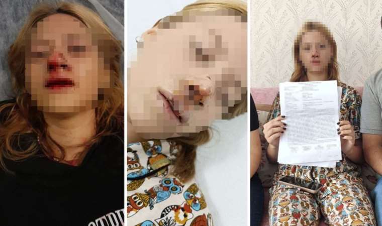 Türkiye Sultangazi'deki vahşeti konuşuyor: Yüzüne kaldırım taşı atıp dişlerini kırdılar, yardıma gelenin kulağını kestiler!