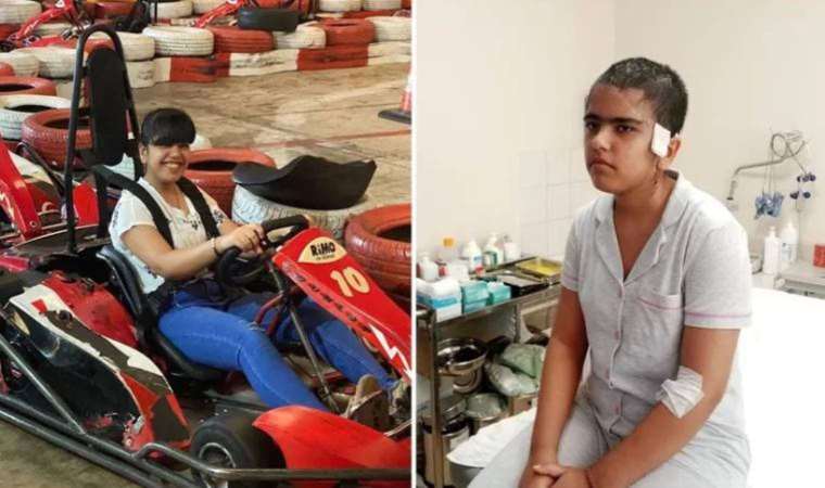 Go-kartın lastiğine saçları dolandı... Ölümden döndü