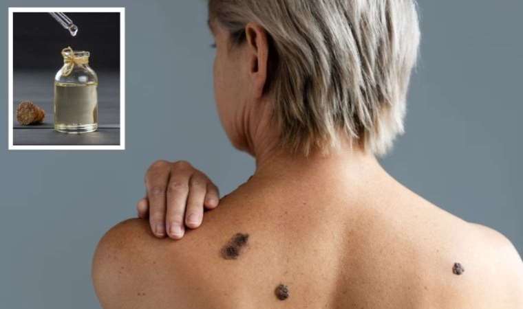 Prof. Dr. İbrahim Saraçoğlu'ndan doğal yollarla et beni düşürme yolları!