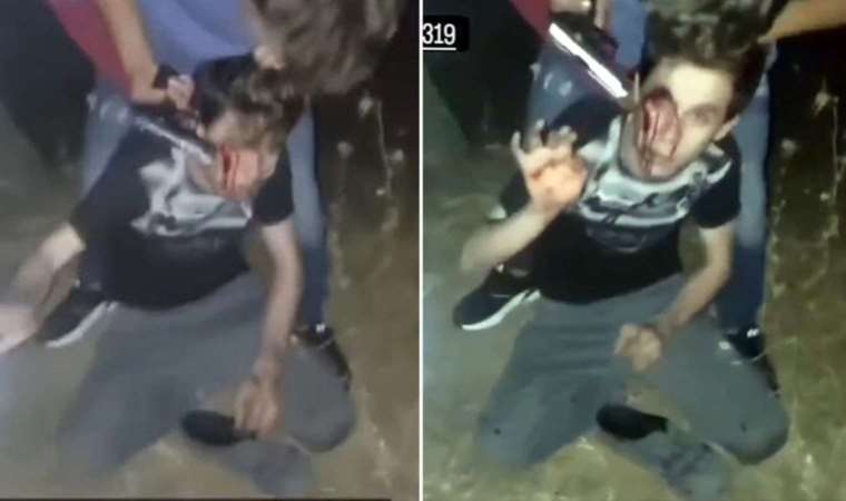 Yabancı uyruklu şahıs engelli genci darbetmişti: Olay hakkında yeni gelişme