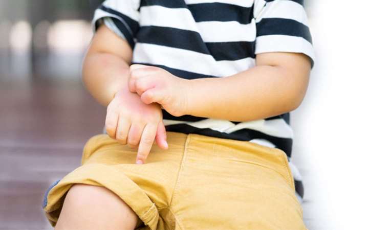 Uzmanlar uyardı: Egzama genellikle çocukluk döneminde başlıyor