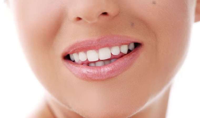 Bu meyve dişleri bembeyaz yapıyor!  2 ay boyunca her gün uygulayın....