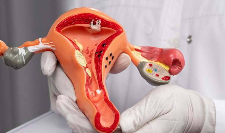 Rahim Ağzı Kanseri hakkında uzman uyarısı: Erken tanı hayati öneme sahip