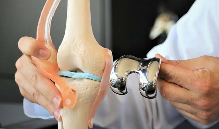 Ortopedi uzmanı anlattı: Diz kireçlenmesi ve tedavisi