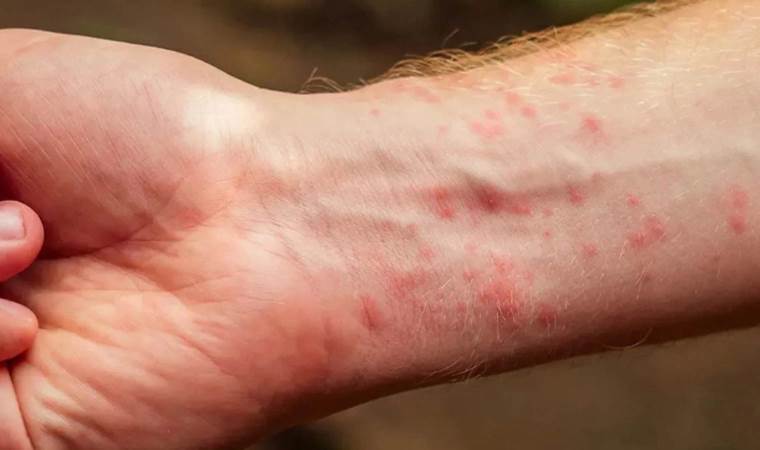 'Doktorlar uyarıda bulundu...'