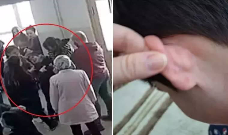 Özel eğitim kurumunda skandal! Yüzde 90 engelli çocuk, öğretmenleri tarafından darbedildi