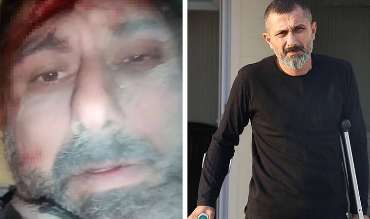 Enkaz altında çektiği video ile tanınmıştı... Dehşet veren anları anlattı: 'Mezardan dar bir yerde 4 gün kaldım'