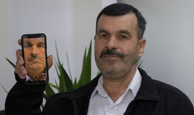 Ağrı ve yüz bozulmalarının sebebi bilinmiyordu, tümör çıktı!