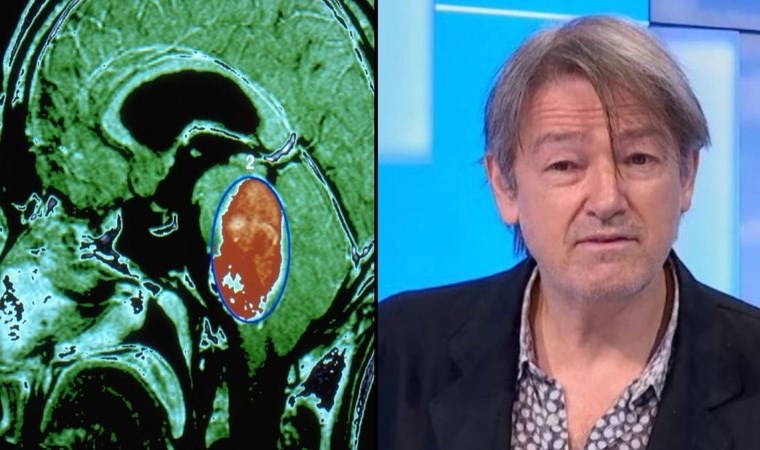 Dünya'da bir ilk: 'Ölümcül' hastalıktan nasıl kurtuldu?