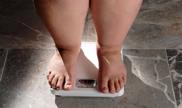 İnsanlığın obezite sınavı