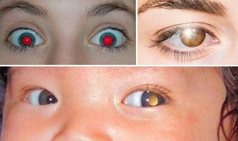 Onalar va ogillar bilan porno tomosha qiling