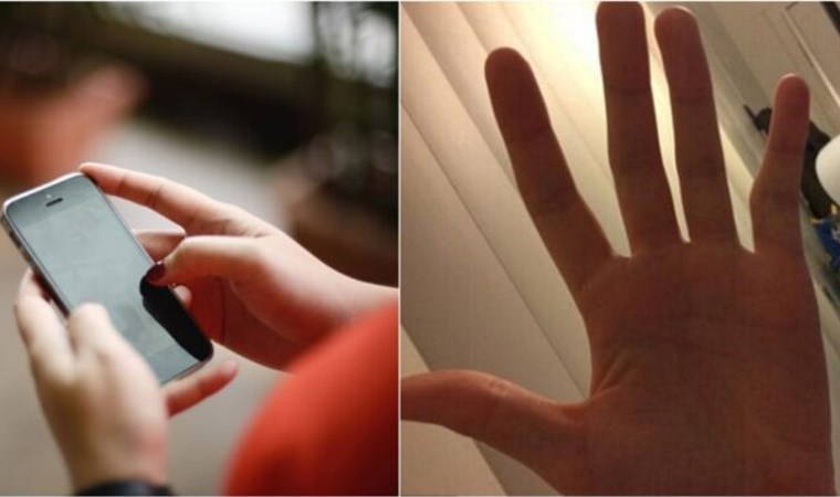 Cep telefonu kullananlara 'yamuk serçe parmak' uyarısı: Cerrahi müdahale gerektirebilir!
