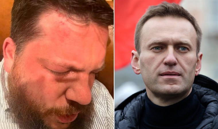 Navalni'ye yakınlığıyla biliniyordu: Çekiçli saldırı