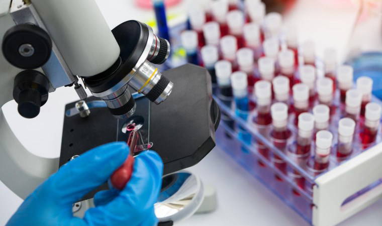 AIDS'te yeni tedavi umudu: HIV'i hücreden ayırma denemesi başarılı oldu